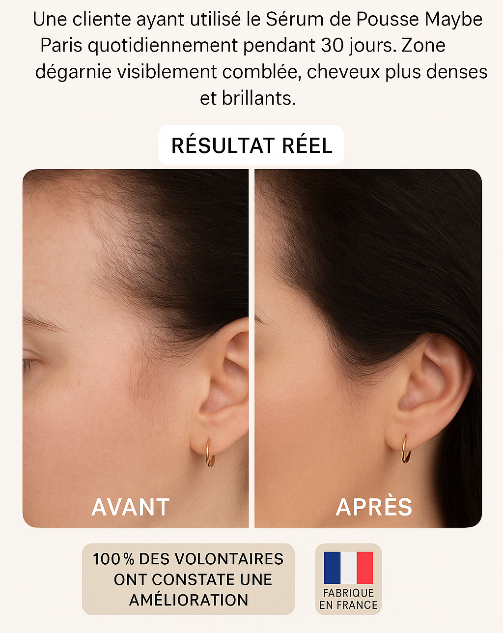 Sérum de Croissance - Efficacité cliniquement prouvée